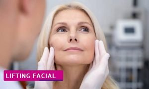 Cuándo hacerse un lifting facial