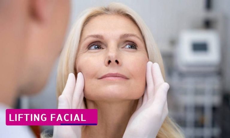 Cuándo hacerse un lifting facial
